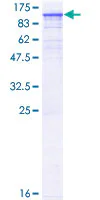 SDS-PAGE - Recombinant Human TNNI3K protein (GST tag N-Terminus) (AB162409)