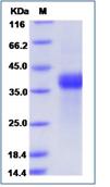 SDS-PAGE - Recombinant Human TNRC5 protein (His tag) (AB276530)