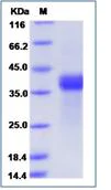SDS-PAGE - Recombinant Human TNRC5 protein (His tag) (AB276530)