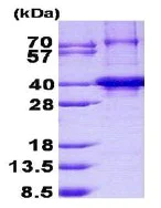 SDS-PAGE - Recombinant Human TNRC5 protein (His tag N-Terminus) (AB140562)