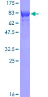 SDS-PAGE - Recombinant Human TOM1 protein (AB160775)