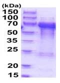 SDS-PAGE - Recombinant Human TOM1L2 protein (His tag N-Terminus) (AB202609)