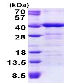 SDS-PAGE - Recombinant Human TOMM34 protein (His tag N-Terminus) (AB156737)