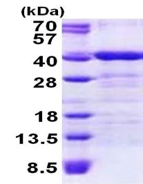 SDS-PAGE - Recombinant Human TOMM34 protein (His tag N-Terminus) (AB156737)