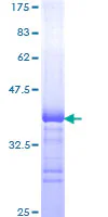 SDS-PAGE - Recombinant Human Topoisomerase II alpha protein (GST tag N-Terminus) (AB159735)