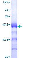 Recombinant Human Topoisomerase II beta/TOP2B protein