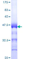 SDS-PAGE - Recombinant Human Topoisomerase II beta/TOP2B protein (GST tag N-Terminus) (AB159736)