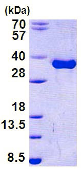 SDS-PAGE - Recombinant Human Torsin A/DYT1 protein (His tag N-Terminus) (AB156747)