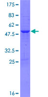 Recombinant Human TP73-AS1 protein