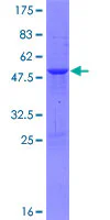 SDS-PAGE - Recombinant Human TP73-AS1 protein (GST tag N-Terminus) (AB163525)