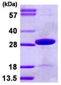 SDS-PAGE - Recombinant Human TPK1 protein (His tag N-Terminus) (AB123150)