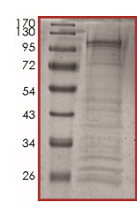Recombinant human TPM3 + ROS1 protein