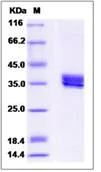 SDS-PAGE - Recombinant Human TPM4 protein (His tag) (AB276611)