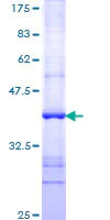 SDS-PAGE - Recombinant Human TPN protein (AB114877)