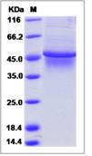 SDS-PAGE - Recombinant Human TPN protein (His tag) (AB276660)