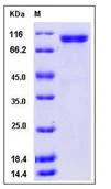 SDS-PAGE - Recombinant Human TPO protein (His tag) (AB276511)