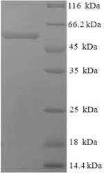 SDS-PAGE - Recombinant Human TPOR/MPL protein (His tag) (AB235820)
