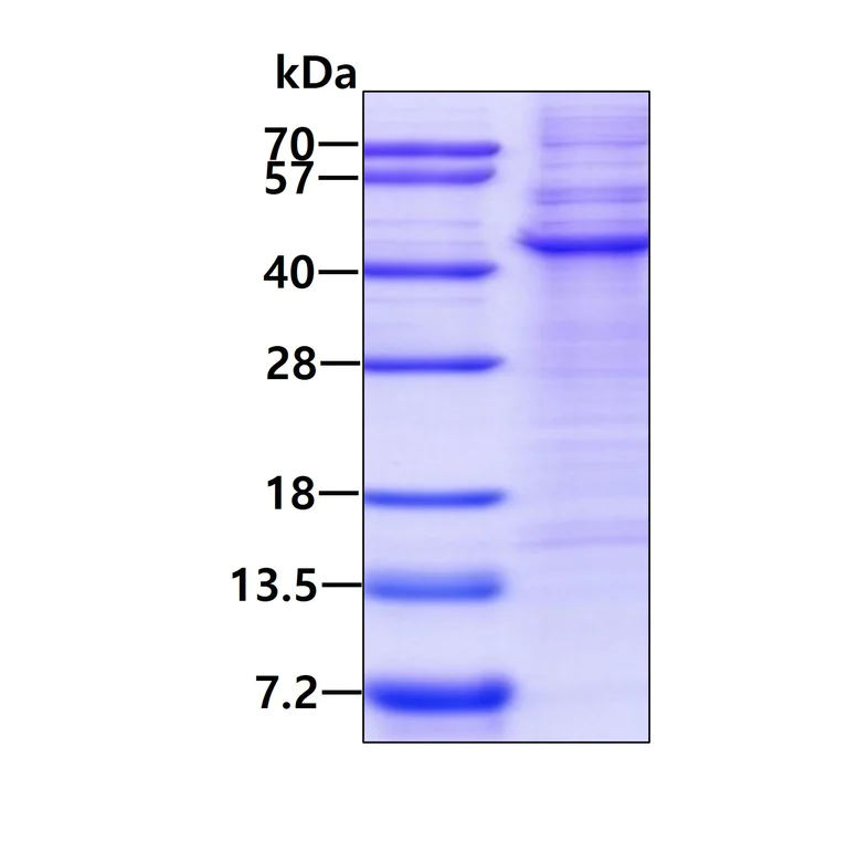 SDS-PAGE - Recombinant Human TPST2 protein (denatured) (His tag N-Terminus) (AB156339)