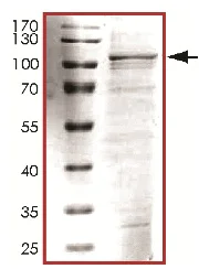 SDS-PAGE - Recombinant Human TPX2 protein (AB119735)