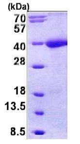 SDS-PAGE - Recombinant Human TR-1 protein (AB156965), expandable thumbnail