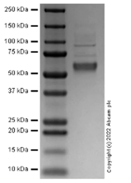 SDS-PAGE - Recombinant Human TR11B Protein (Active) (AB287918)