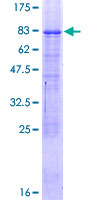 SDS-PAGE - Recombinant Human TR2-11 protein (AB159745), expandable thumbnail