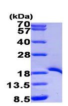 SDS-PAGE - Recombinant Human TRAF1 protein (His tag N-Terminus) (AB95858)