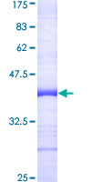 Recombinant Human TRAF7 protein