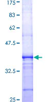 SDS-PAGE - Recombinant Human Transferrin Receptor protein (AB159687)