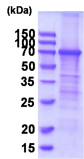 SDS-PAGE - Recombinant Human Transferrin Receptor protein (denatured) (AB202198)