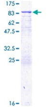 SDS-PAGE - Recombinant Human Transglutaminase 2 protein (AB152748), expandable thumbnail