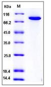 SDS-PAGE - Recombinant Human Transglutaminase 2 protein (His tag) (AB276359), expandable thumbnail