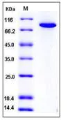 SDS-PAGE - Recombinant Human Transglutaminase 2 protein (His tag) (AB276359)