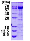 SDS-PAGE - Recombinant Human Transketolase protein (His tag N-Terminus) (AB124315)