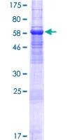 SDS-PAGE - Recombinant Human Transmembrane protein 30A (AB163206)