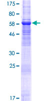 SDS-PAGE - Recombinant Human Transmembrane protein 30A (GST tag N-Terminus) (AB163206)