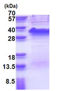 SDS-PAGE - Recombinant Human TRAP alpha/TRAPA protein (His tag N-Terminus) (AB176076)