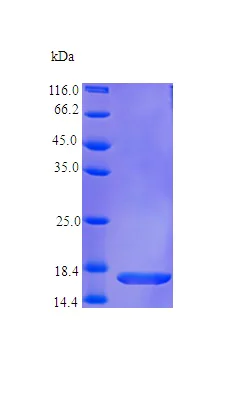 SDS-PAGE - Recombinant human TRAP/CD40L protein (AB237557)