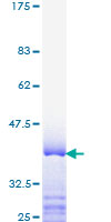 SDS-PAGE - Recombinant Human TRAP220/MED1 protein (AB159163), expandable thumbnail