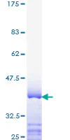 SDS-PAGE - Recombinant Human TRAP220/MED1 protein (GST tag N-Terminus) (AB159163)