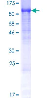 SDS-PAGE - Recombinant Human TRAPPC11 protein (AB163740)