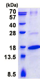 SDS-PAGE - Recombinant Human TRAPPC2 protein (His tag N-Terminus) (AB136702)