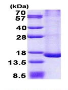 SDS-PAGE - Recombinant Human TRAPPC2L protein (AB167906)