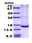 SDS-PAGE - Recombinant Human TRAPPC2L protein (His tag N-Terminus) (AB167906)