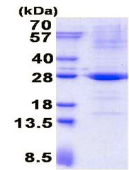 SDS-PAGE - Recombinant Human TRAPPC4 protein (His tag N-Terminus) (AB136708)