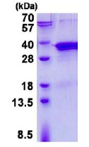 SDS-PAGE - Recombinant Human TRAX protein (AB137155)
