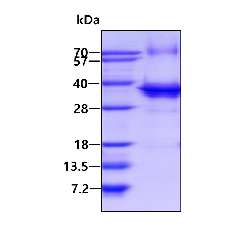 SDS-PAGE - Recombinant Human TRAX protein (AB137155)
