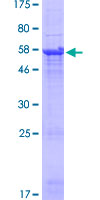 SDS-PAGE - Recombinant Human TRBV5-4 protein (AB162170), expandable thumbnail