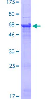 SDS-PAGE - Recombinant Human TRBV5-4 protein (GST tag N-Terminus) (AB162170)