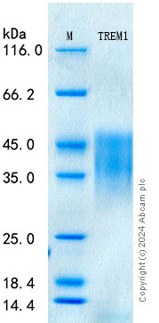 SDS-PAGE - Recombinant Human TREM-1 Protein Standard (His tag) (AB316599), expandable thumbnail